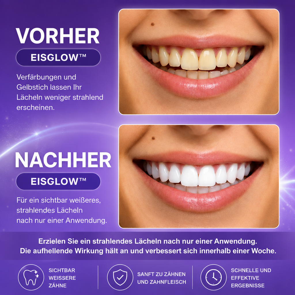 14 Aufhellungsstreifen