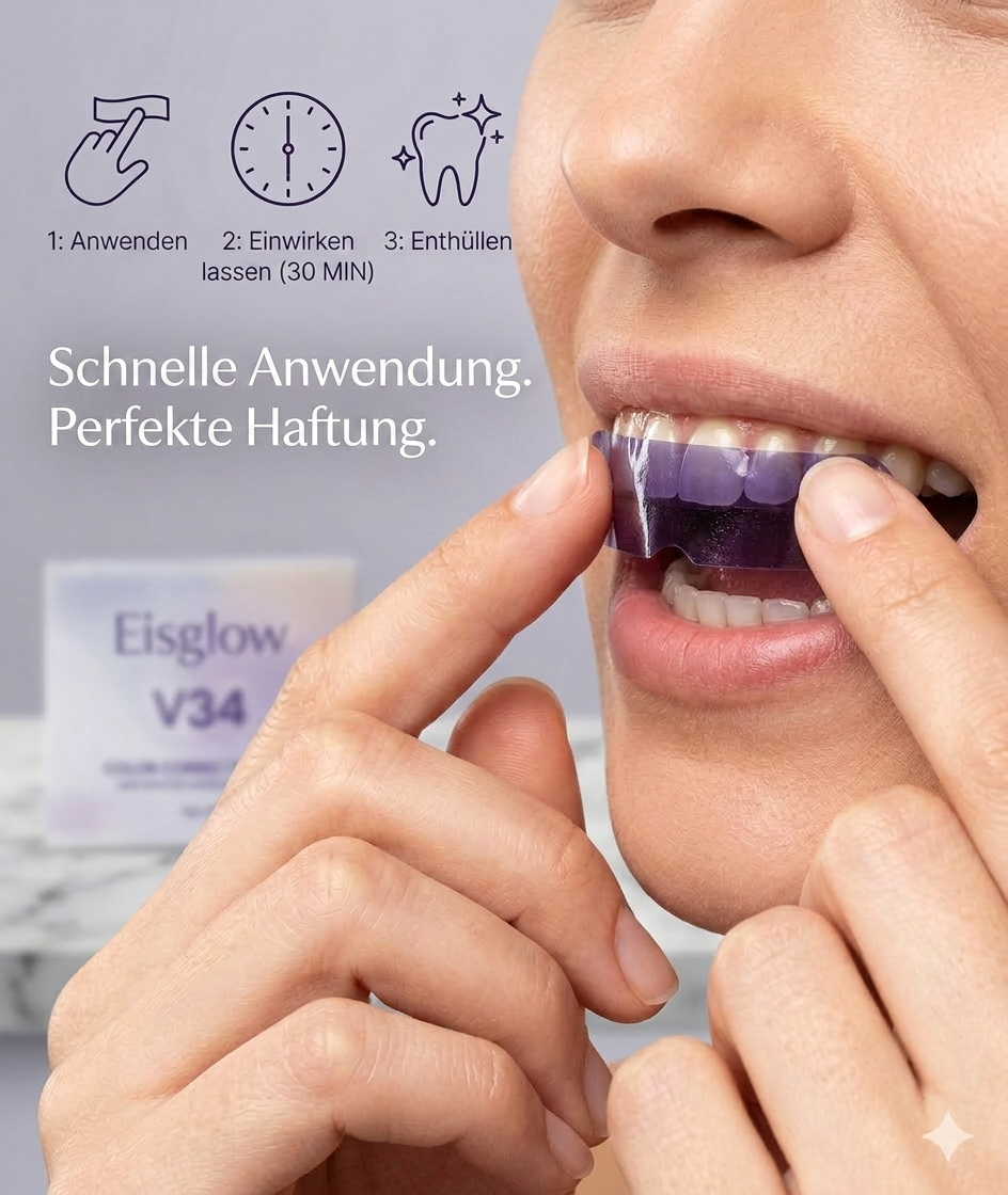 14 Aufhellungsstreifen